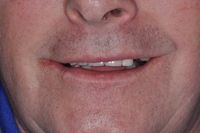 Larry Brooks before